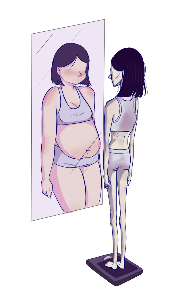 pessoa com anorexia